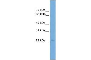 WB Suggested Anti-COPS8  Antibody Titration: 0. (COPS8 抗体  (Middle Region))