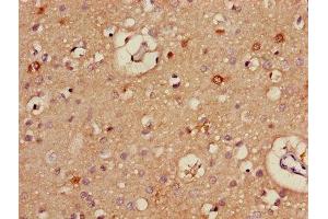 Immunohistochemistry of paraffin-embedded human brain tissue using ABIN7170921 at dilution of 1:100 (ALDH5A1 抗体  (AA 48-535))