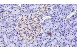 Detection of PIIINP in Human Pancreas Tissue using Polyclonal Antibody to Procollagen III N-Terminal Propeptide (PIIINP) (PIIINP 抗体)