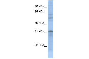WB Suggested Anti-MTCH2 Antibody Titration: 0. (MTCH2 抗体  (N-Term))