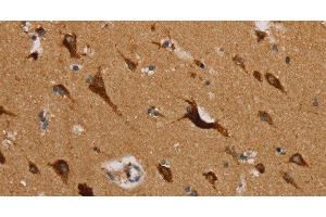 Immunohistochemistry of paraffin-embedded Human brain using MRPL39 Polyclonal Antibody at dilution of 1:45 (MRPL39 抗体)