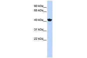 ADH4 antibody used at 1 ug/ml to detect target protein. (ADH4 抗体)