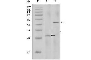 Western Blot showing IL2 antibody used against full-length IL2 recombinant protein with Trx tag (1) and full-length IL2-hIgGFc transfected HEK293 cell lysate (2). (IL-2 抗体)