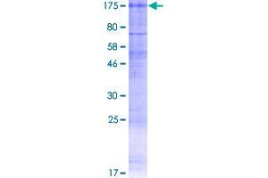 CLCN1 Protein (AA 1-988) (GST tag)