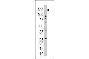 The USP28 polyclonal antibody  is used in Western blot to detect USP28 in Jurkat cell lysate . (USP28 抗体  (N-Term))