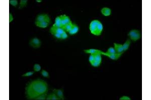 Immunofluorescence staining of MCF-7 cells with ABIN7167413 at 1:105, counter-stained with DAPI. (RASAL1 抗体  (AA 698-804))