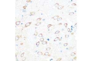 Immunohistochemistry of paraffin-embedded rat brain using TCTP/TPT1 Rabbit mAb (ABIN7271101) at dilution of 1:100 (40x lens). (TPT1 抗体)
