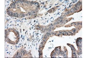 Immunohistochemical staining of paraffin-embedded Human pancreas tissue using anti-NXNL2 mouse monoclonal antibody. (NXNL2 抗体)