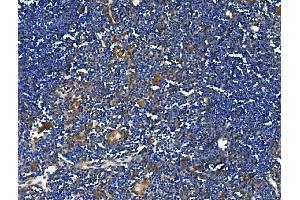 IHC analysis of TRIM6 using anti-TRIM6 antibody (ABIN7601905).