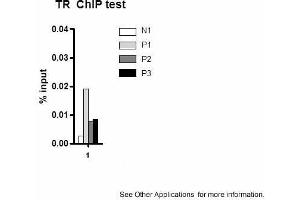Application: ChIPSample Type: mouse liver tissueChromatin Used: 100ug tissueAntibody Used: 10ug  Image Submitted by: Joanna DiSpiritoUniversity of Pennsylvania (THRB 抗体  (N-Term))