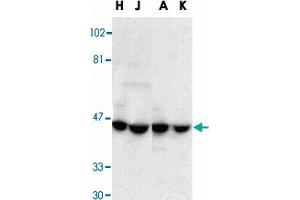 Western blot analysis of DFFA in HeLa (H), Jurkat (J), A-431 (A), and K-562 (K) whole cell lysate with DFFA polyclonal antibody  at 1 : 1000 dilution.