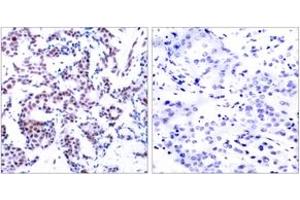 Immunohistochemistry (IHC) image for anti-Jun B Proto-Oncogene (JUNB) (pSer259) antibody (ABIN2888458) (JunB 抗体  (pSer259))