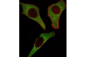 Fluorescent image of Hela cell stained with CDK4 Antibody . (CDK4 抗体  (C-Term))