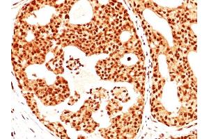 Immunohistochemistry (IHC) image for anti-Estrogen Receptor 2 (ESR2) (C-Term) antibody (ABIN6939350)