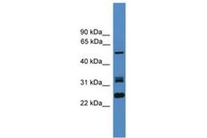 Image no. 1 for anti-Leucine Rich Repeat (In FLII) Interacting Protein 2 (LRRFIP2) (AA 51-100) antibody (ABIN6745323) (LRRFIP2 抗体  (AA 51-100))