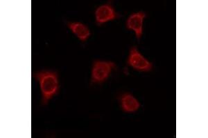 ABIN6275034 staining Hela by IF/ICC. (CD55 抗体  (Internal Region))