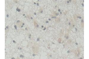 Immunohistochemistry (IHC) image for anti-ATP-Binding Cassette, Sub-Family B (MDR/TAP), Member 5 (ABCB5) (AA 570-808) antibody (ABIN7442258)