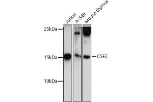 Western blot analysis of extracts of various cell lines, using CSF2 antibody (ABIN6130426, ABIN6139094, ABIN6139095 and ABIN6221725) at 1:500 dilution. (GM-CSF 抗体  (AA 18-144))