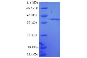 SDS-PAGE (SDS) image for Enhancer of Rudimentary Homolog (ERH) (AA 2-104), (full length) protein (GST tag) (ABIN7479263)