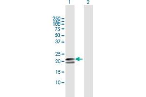 Western Blotting (WB) image for anti-Myosin, Light Chain 1, Alkali, Skeletal, Fast (MYL1) (AA 1-194) antibody (ABIN948160)