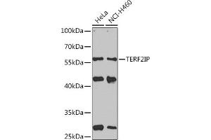 Western Blotting (WB) image for anti-Telomeric Repeat Binding Factor 2, Interacting Protein (TERF2IP) (AA 1-280) antibody (ABIN7270764)