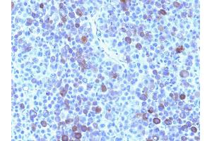 Immunohistochemistry (IHC) image for anti-Glypican 3 (GPC3) antibody (ABIN6939525)