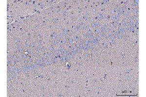 IHC analysis of GNB3 using anti-GNB3 antibody (ABIN7599726).