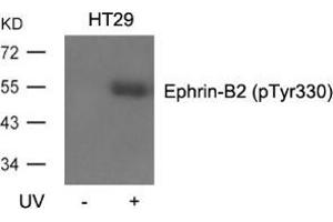 Western blot analysis of extracts from HT29 cells, untreated or treated with UV using Ephrin-B2 (Phospho-Tyr330). (Ephrin B2 抗体  (pTyr330))