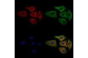 ABIN6263407 and ABIN6279151 staining Hela cells by IF/ICC.