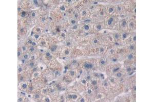 Used in DAB staining on fromalin fixed paraffin- embedded liver tissue (PTP4A2 抗体  (AA 1-167))