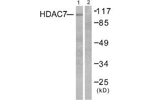 Western blot analysis of extracts from HuvEc cells, using HDAC7 antibody (ABIN5976424). (HDAC7 抗体  (C-Term))