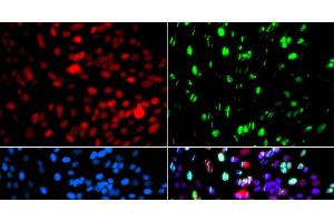 Immunofluorescence analysis of GFP-RNF168 transgenic U2OS cells using POLD3 Polyclonal Antibody (POLD3 抗体)