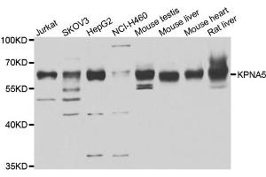 Western blot analysis of extracts of various cell lines, using KPNA5 antibody. (KPNA5 抗体)