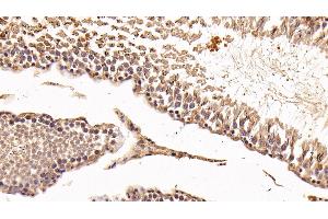 Immunohistochemistry (IHC) image for anti-Lectin, Galactoside-Binding, Soluble, 8 (LGALS8) (AA 1-317) antibody (ABIN7431593)