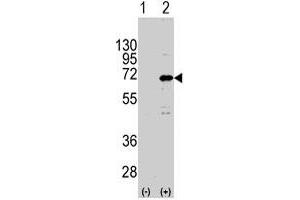 Western blot analysis of CNOT4 (arrow) using rabbit CNOT4 polyclonal antibody . (CNOT4 抗体  (N-Term))