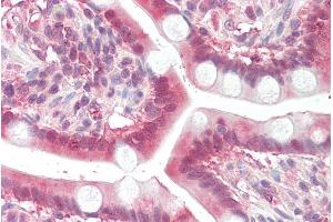 ABIN571230 (3. (MOGAT2 抗体  (Internal Region))