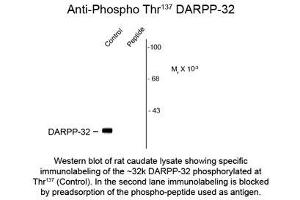 Image no. 1 for anti-Protein Phosphatase 1, Regulatory (Inhibitor) Subunit 1B (PPP1R1B) (pSer137) antibody (ABIN956747)