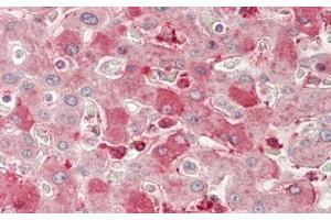 Detection of NRP1 in Human Liver Tissue using Polyclonal Antibody to Neuropilin 1 (NRP1) (Neuropilin 1 抗体  (AA 646-814))
