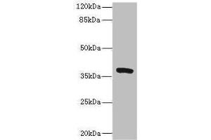 Western blot All lanes: TMEM64 antibody at 8 μg/mL + Mouse brain tissue Secondary Goat polyclonal to rabbit IgG at 1/10000 dilution Predicted band size: 40, 13, 15, 34 kDa Observed band size: 40 kDa (TMEM64 抗体  (AA 40-118))