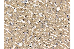 ABIN6257613 and ABIN6274480 at 1/100 staining rat heart tissue by IHC-P. (LMTK3 抗体  (Internal Region))