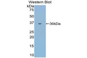 Western blot analysis of the recombinant protein. (Transferrin 抗体)