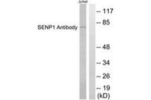 Western blot analysis of extracts from Jurkat cells, using SENP1 Antibody. (SENP1 抗体  (AA 1-50))