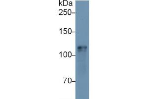 Western blot analysis of Mouse Heart lysate, using Mouse HK1 Antibody (1 µg/ml) and HRP-conjugated Goat Anti-Rabbit antibody ( (Hexokinase 1 抗体  (AA 137-270))