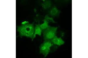 Anti-C21orf59 mouse monoclonal antibody (ABIN2452868) immunofluorescent staining of COS7 cells transiently transfected by pCMV6-ENTRY C21orf59 (RC200169). (C21orf59 抗体)