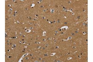 The image on the left is immunohistochemistry of paraffin-embedded Human brain tissue using ABIN7130524(PAEP Antibody) at dilution 1/60, on the right is treated with fusion protein. (PAEP 抗体)