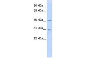 Image no. 1 for anti-Dihydroorotate Dehydrogenase (DHODH) (AA 180-229) antibody (ABIN6740743) (DHODH 抗体  (AA 180-229))