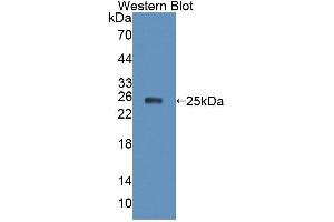 Western blot analysis of the recombinant protein. (XPO5 抗体  (AA 2-180))