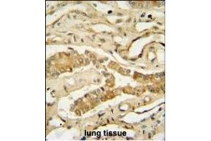 anti-NADH Dehydrogenase (Ubiquinone) Complex I, Assembly Factor 3 (NDUFAF3) (AA 12-40), (N-Term) antibody