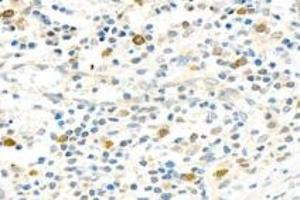 Immunohistochemistry analysis of paraffin-embedded human appendix using,PARP1 (ABIN7075114) at dilution of 1: 750 (PARP1 抗体  (cleaved))