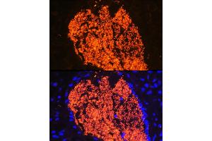 Immunofluorescence analysis of Mouse placenta using HB antibody (ABIN6129603, ABIN6141637, ABIN6141638 and ABIN6224486) at dilution of 1:100 (40x lens). (HBa2 抗体  (AA 1-142))